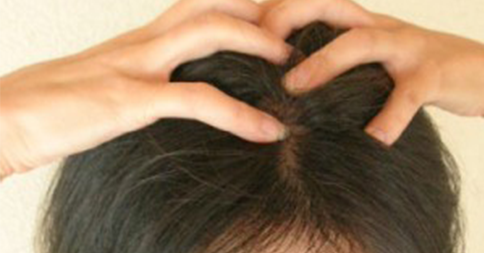 【衝撃】頭皮の血行を良くすると逆にハゲるらしい…