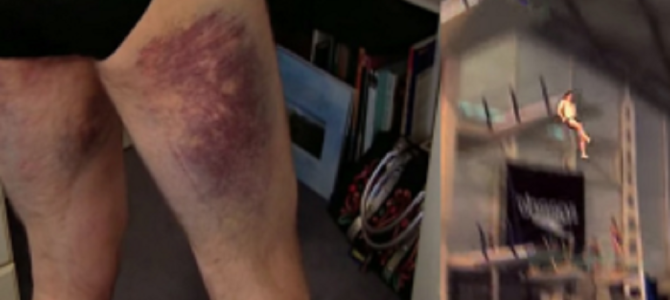 高飛び込みでちょっと入水角度を誤ると大変なことに！？