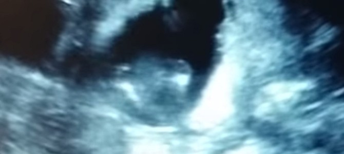 歌に合わせてお腹の赤ちゃんが手を叩いた！