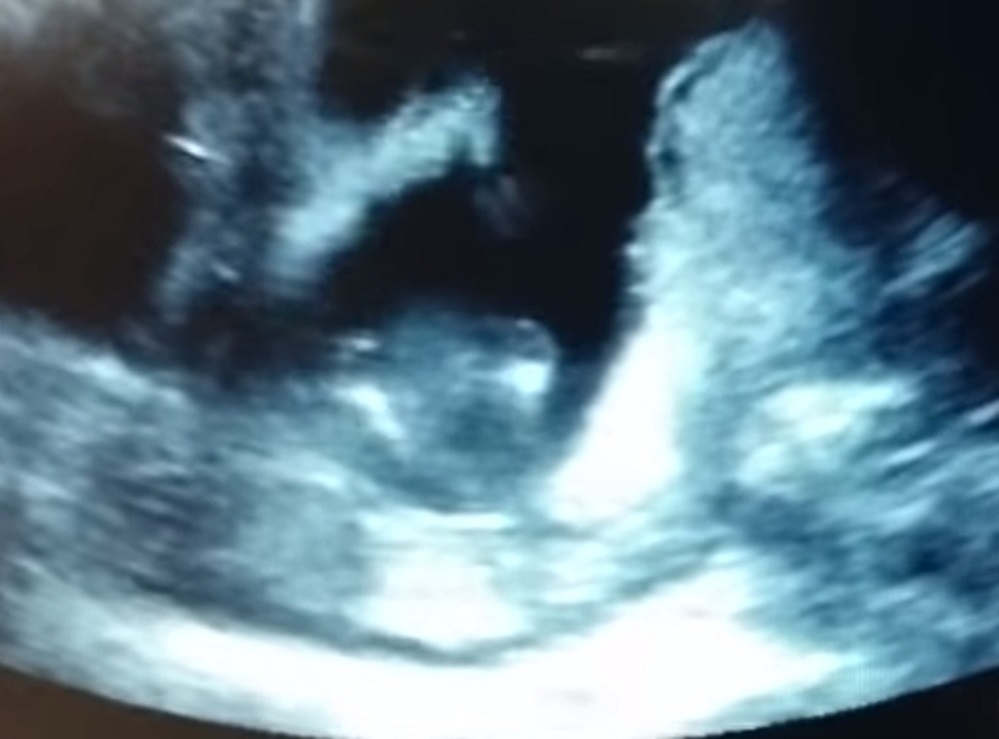 a34e6f092c3791dccd316f0e4ee3bf0f