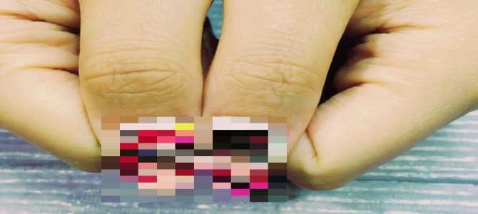 痛ネイルで本当に痛い目にあってしまったツイートに同情リプライの嵐 痛ネイルで本当に痛い目にあってしまったツイートに同情リプライの嵐