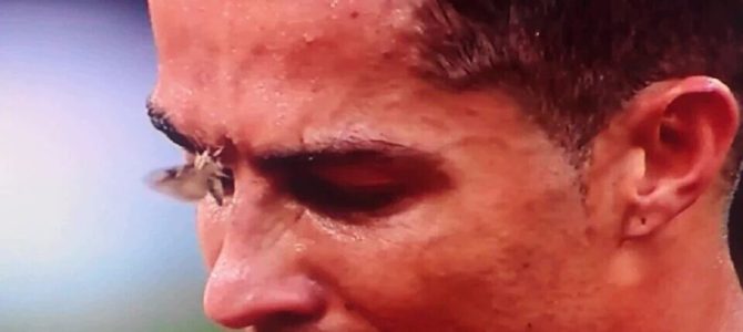 クリスティアーノ・ロナウドの瞼に止まった“あるもの”とは