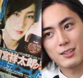 間宮祥太朗の目が一重から二重になった理由