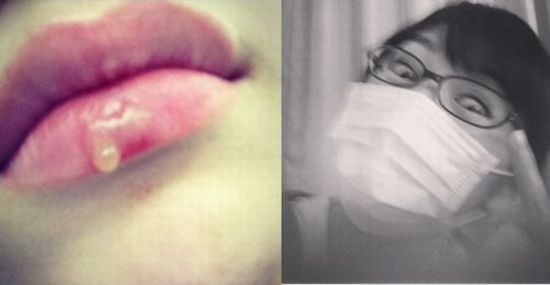 【重症】渡辺麻友に「若いのによくやるね。整形モンスター」と侮辱されたHKT48宮脇咲良、超病んでいることが判明！！