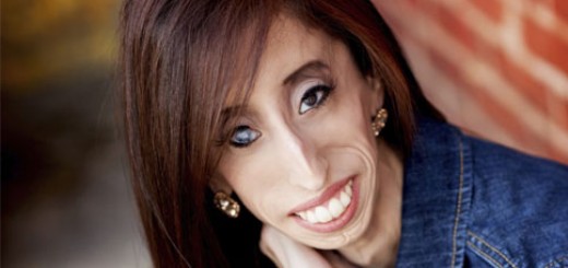 世界中で1番醜い女と罵られた女性が話すポジティブな言葉に勇気づけられる