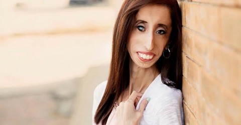 【動画】世界で一番醜い女と誹謗中傷された女性が話す『いじめに勝つ方法』が素晴らしい