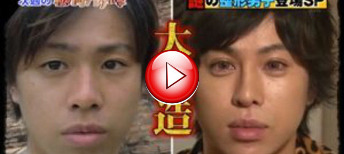 整形男子アレンさんの最新の姿をご覧ください！！