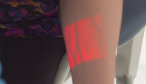 血管を浮かび上がらせる医療機器がすごい！これで失敗することはない！