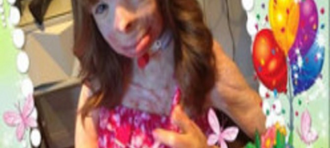 火事で家族を失い残された少女の願い。世界中からX’masカードが届くネットの奇跡! 火事で家族を失い残された少女の願い。世界中からX’masカードが届くネットの奇跡!