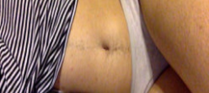 Twitterに下着姿の自撮りを投稿したら、まさかの炎上！そのワケ