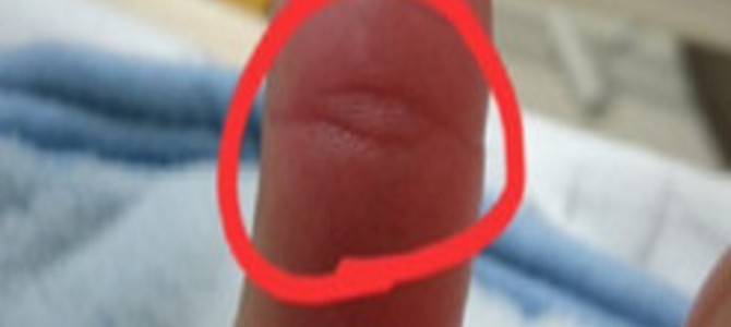 左手の親指をよ～く見て！第一関節に目のような手相「仏眼」がある人は