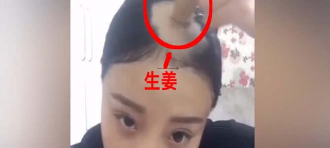 ドリルで禿げたあの女の子が「生姜」で頭皮ケア！？