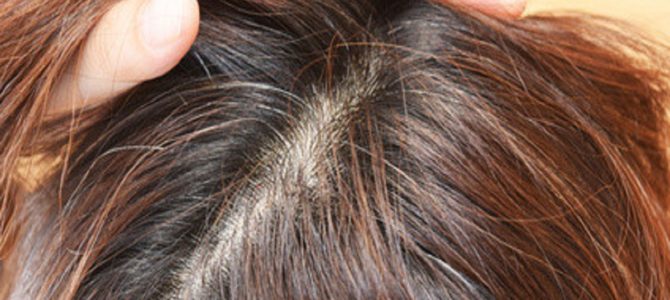 白髪の生える場所で分かる、体の不調を現すサインとは？