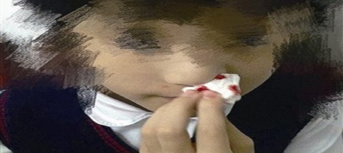 全校生徒3分の2が体調不良を訴える。中国で急増する「毒学校」による健康被害