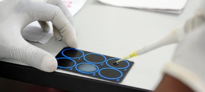 研究所で遊んでいた子供たちが知らずにHIV陽性血液サンプルで遊ぶ