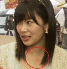 【HKT48を卒業】指原莉乃の流出画像がヤバすぎる！『指原莉乃 彼氏 キスマイ』とは？