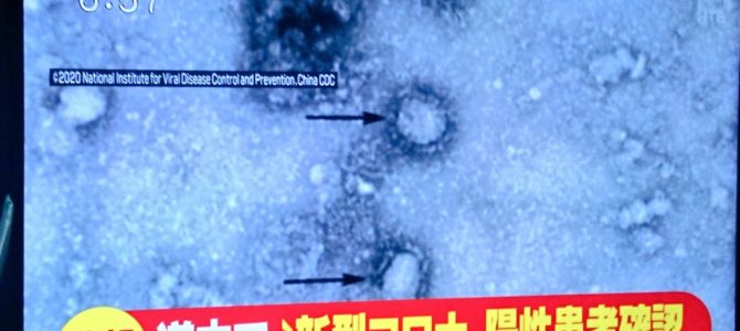 北海道のコロナウイルス感染者の入院先は？