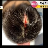 【岡山】スイミングスクールで男児に水筒を投げて3針縫う怪我
